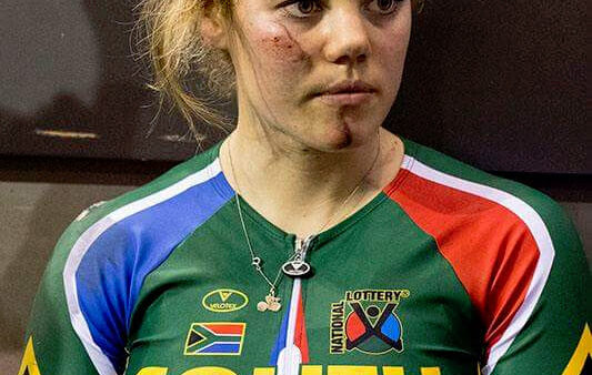 Beyers on the track to recovery
